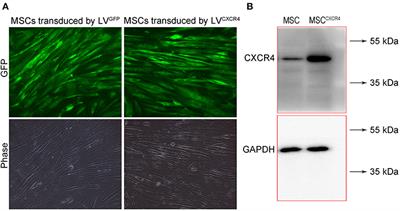 The Antitumor Effect of Gene-Engineered Exosomes in the Treatment of Brain Metastasis of Breast Cancer